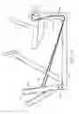 Fig. 14 - Exercise Apparatus With an Inertia System