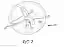 Fig. 03 - Coil spring connector loop handle