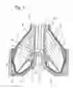 Fig. 02 - Separator with rib body arranged in admission chamber