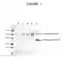 Fig. 391 - Crystal structure of isoglutaminyl cyclase
