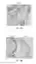 Fig. 40 - Semi-Invasive Method for Characterizing Lung Injury