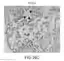 Fig. 41 - Semi-Invasive Method for Characterizing Lung Injury