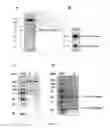 Fig. 04 - Immunoglobulin libraries