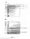 Fig. 20 - Immunoglobulin libraries