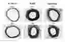 Fig. 01 - Method of Inhibiting Smooth Muscle Cell Proliferation by Using Reconstituted HDL