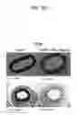 Fig. 04 - Method of Inhibiting Smooth Muscle Cell Proliferation by Using Reconstituted HDL