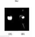 Fig. 03 - Leptin agonist and methods of use