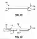 Fig. 09 - Methods for renal denervation