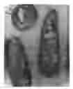 Fig. 01 - Method of treating tumors