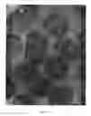 Fig. 02 - Method of treating tumors
