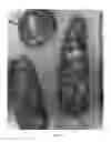 Fig. 03 - Method of treating tumors