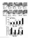 Fig. 07 - Hedgehog Pathway Antagonists and Methods of Use