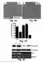 Fig. 08 - Hedgehog Pathway Antagonists and Methods of Use
