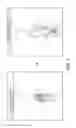 Fig. 06 - Injectable composition containing hydroxychloroquine for local administration for treating hemorrhoids
