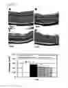 Fig. 05 - COMPOSITIONS AND METHODS FOR THE TREATMENT OF OCULAR OXIDATIVE STRESS AND RETINITIS PIGMENTOSA