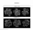 Fig. 09 - METHODS AND COMPOSITIONS FOR TREATING OPHTHALMIC CONDITIONS