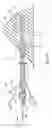 Fig. 08 - Expandable brachytherapy apparatus and methods for using them