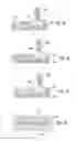 Fig. 04 - Brachytherapy Devices and Related Methods Providing Bioaborbability and/or Asymmetric Irradiation