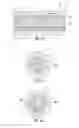 Fig. 05 - Brachytherapy Devices and Related Methods Providing Bioaborbability and/or Asymmetric Irradiation