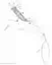 Fig. 01 - Skin interface for ventricular assist device