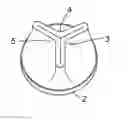 Fig. 01 - Urological device