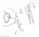Fig. 24 - Urological device