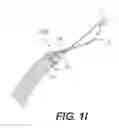 Fig. 06 - Sling anchor system