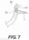 Fig. 15 - Sling anchor system