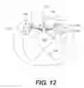Fig. 20 - Sling anchor system