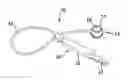 Fig. 01 - Gastric band device and method