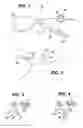 Fig. 02 - Gastric band device and method