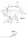 Fig. 04 - Gastric band device and method