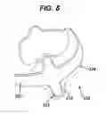 Fig. 05 - Gastric band device and method