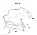 Fig. 06 - Gastric band device and method