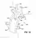 Fig. 07 - Gastric band device and method