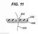 Fig. 08 - Gastric band device and method