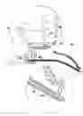 Fig. 01 - IMPLANT FOR SUPPORTING THE PELVIC FLOOR