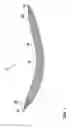 Fig. 02 - IMPLANT FOR SUPPORTING THE PELVIC FLOOR