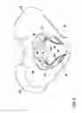 Fig. 03 - IMPLANT FOR SUPPORTING THE PELVIC FLOOR