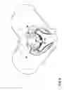 Fig. 04 - IMPLANT FOR SUPPORTING THE PELVIC FLOOR