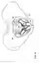 Fig. 14 - IMPLANT FOR SUPPORTING THE PELVIC FLOOR