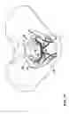 Fig. 15 - IMPLANT FOR SUPPORTING THE PELVIC FLOOR
