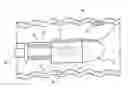 Fig. 01 - Endoscopic Resection Devices and Related Methods of Use