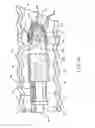 Fig. 05 - Endoscopic Resection Devices and Related Methods of Use