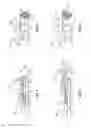 Fig. 02 - MIRRORED ARTHROSCOPE