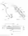Fig. 03 - Rotate-to-advance catheterization system