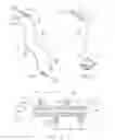 Fig. 04 - Rotate-to-advance catheterization system