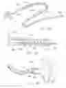 Fig. 13 - Rotate-to-advance catheterization system