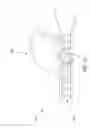 Fig. 52 - Rotate-to-advance catheterization system