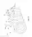 Fig. 53 - Rotate-to-advance catheterization system